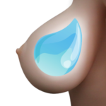 Gel Breasts (More Jiggly)